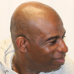 deion_s_before_right