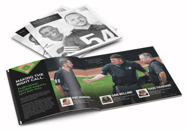 Male Baldness Gene: Does it Come from Your Mother or Father?