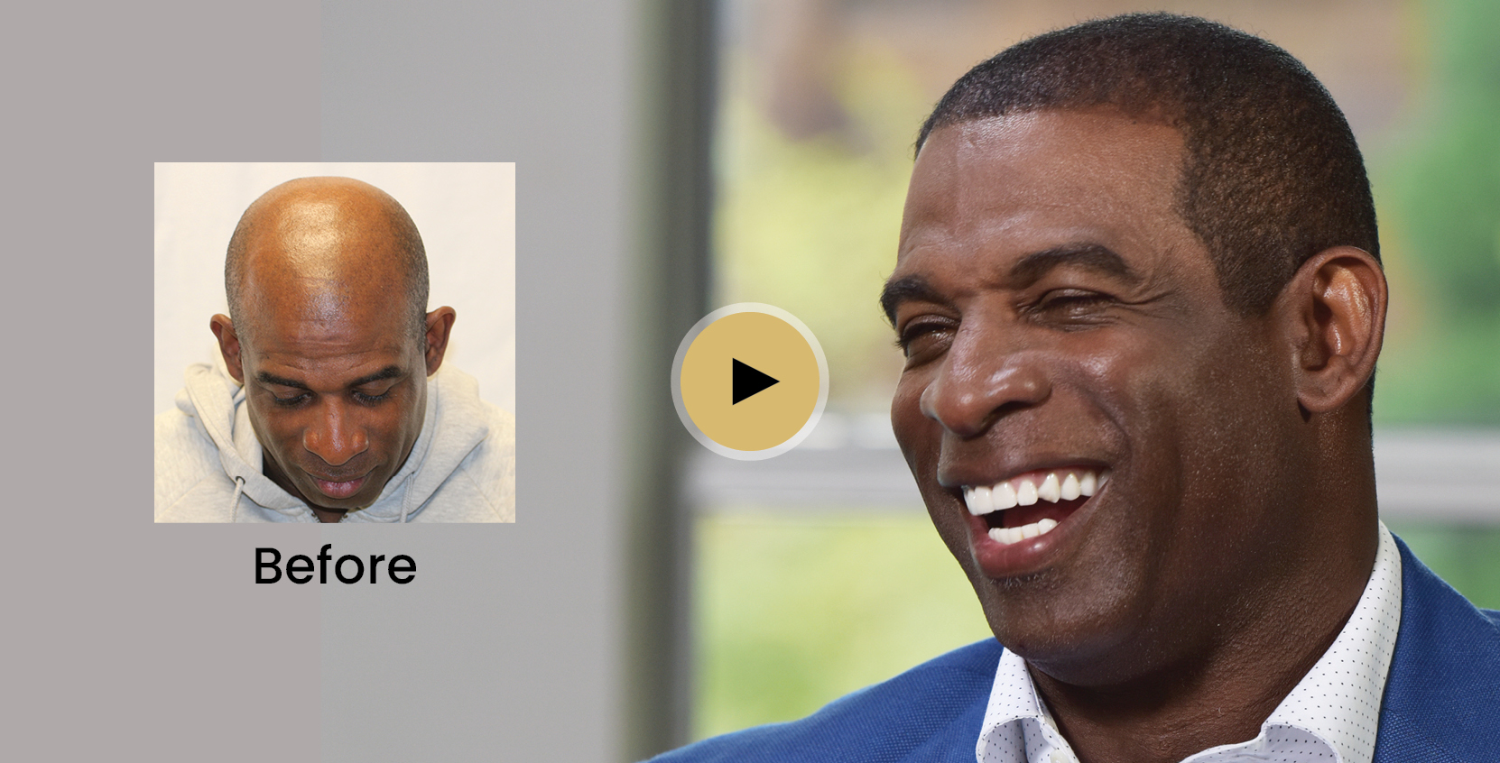 Deion Sanders and RESTORE Hair Deion Sanders and RESTORE Hair