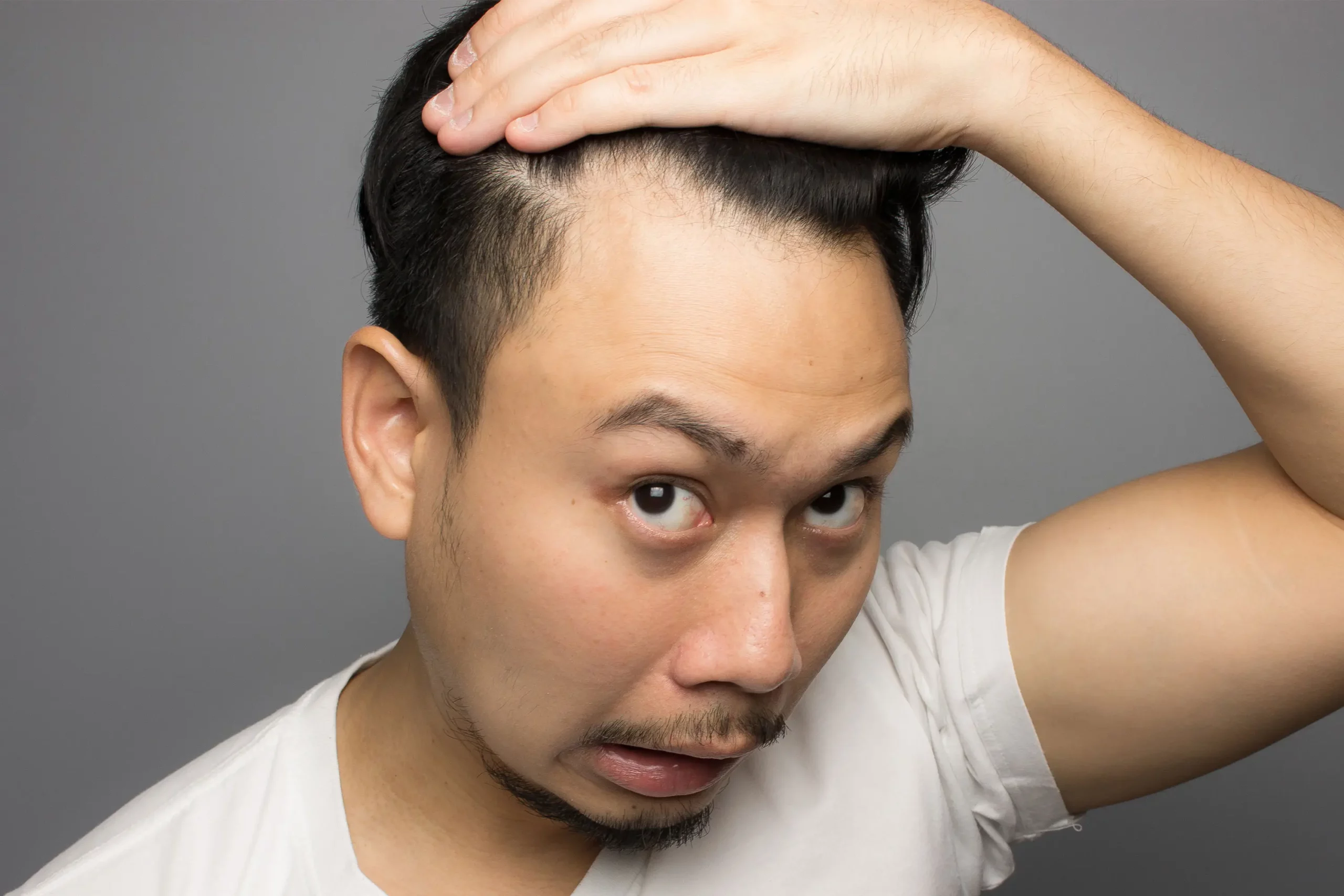 A guy showing off his hairline