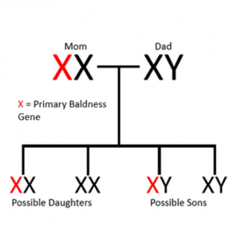 male pattern baldness Gene male pattern baldness Gene