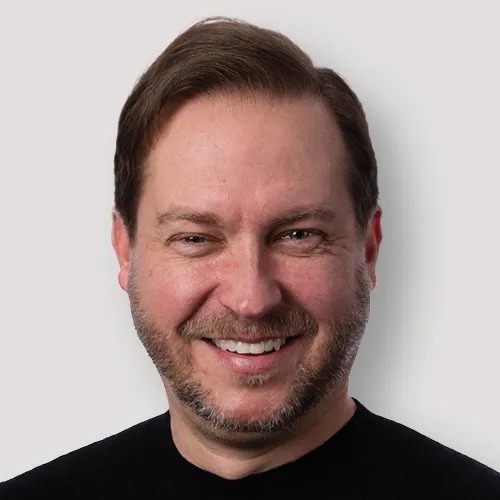 James W. after hair transplant