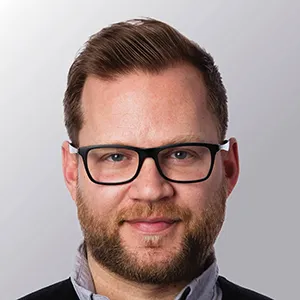 Nick G. after hair transplant