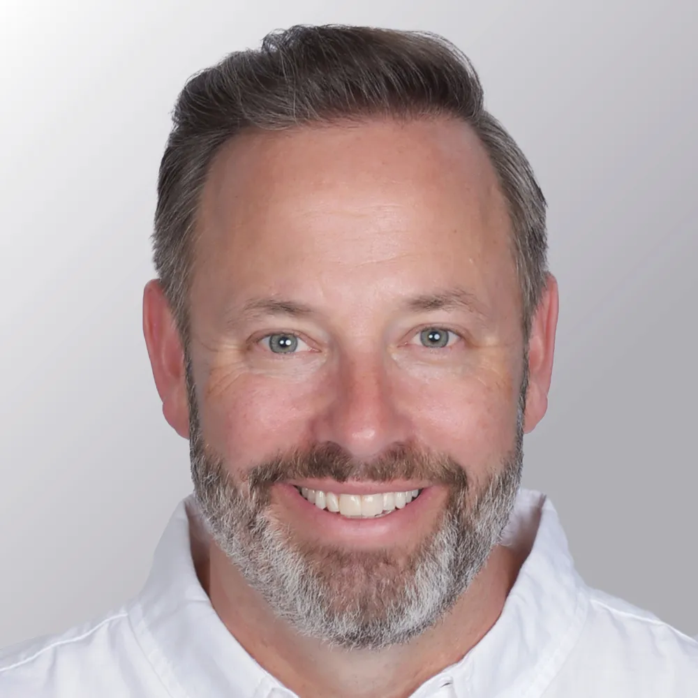 Todd D. after hair transplant