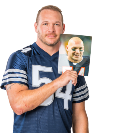 Brian Urlacher Hair Transplant Results | RESTORE Hair