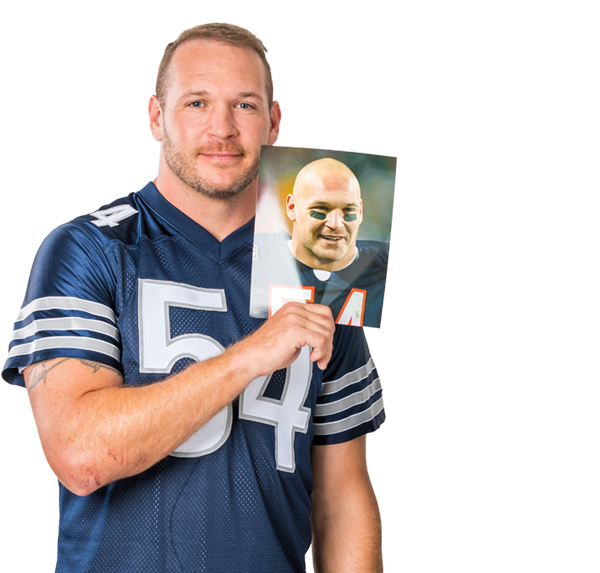  Brian Urlacher RESTORE Hair Results