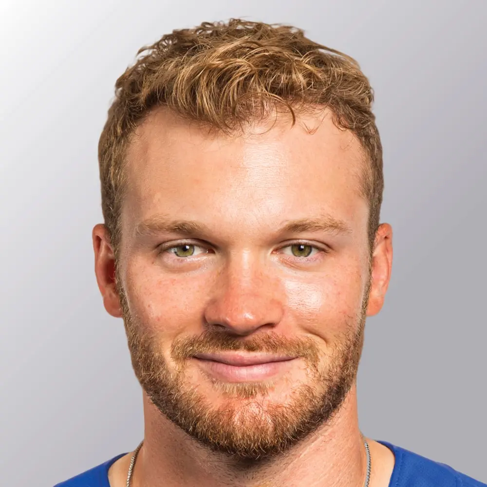 Ian Happ after hair transplant