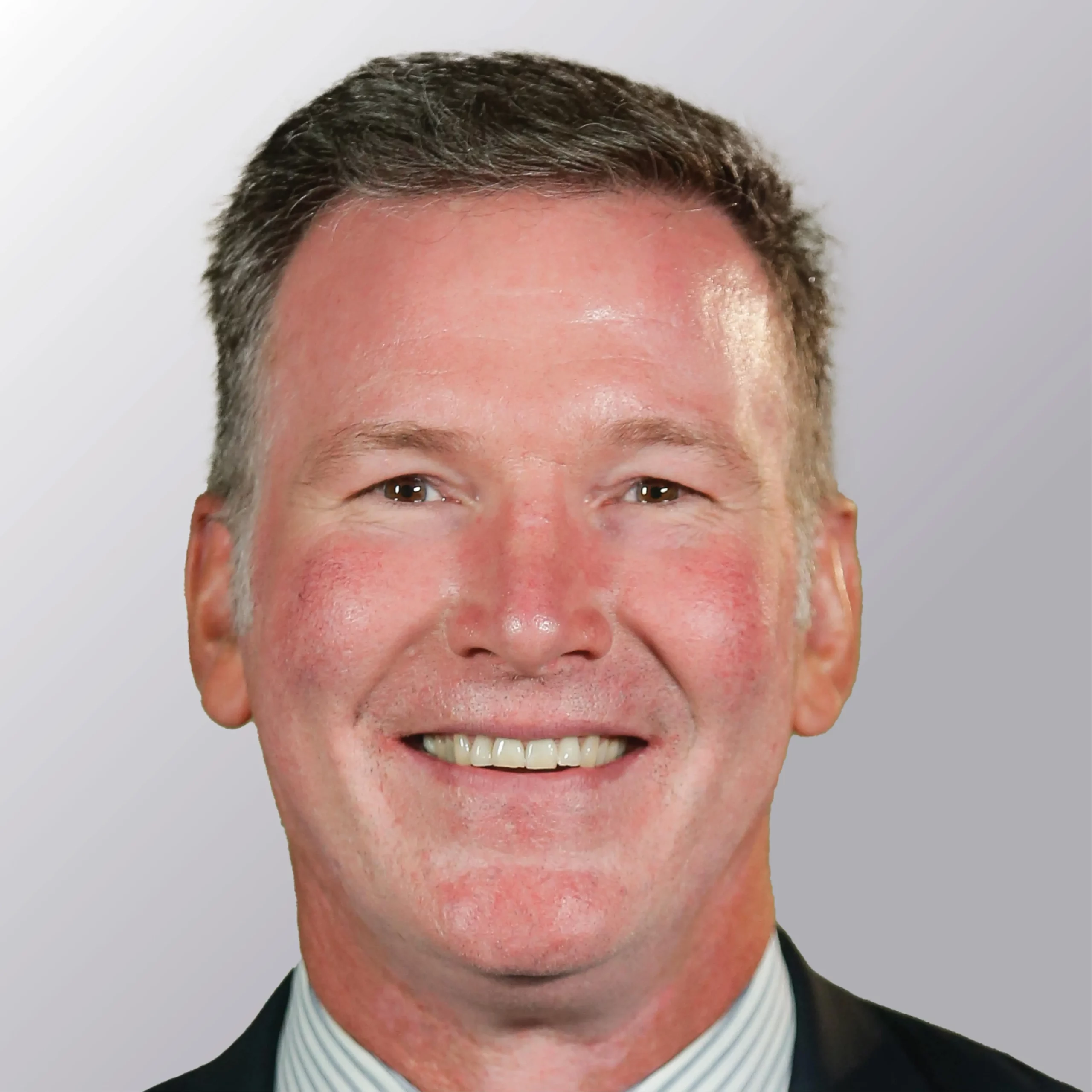Jim Cornelison after hair transplant