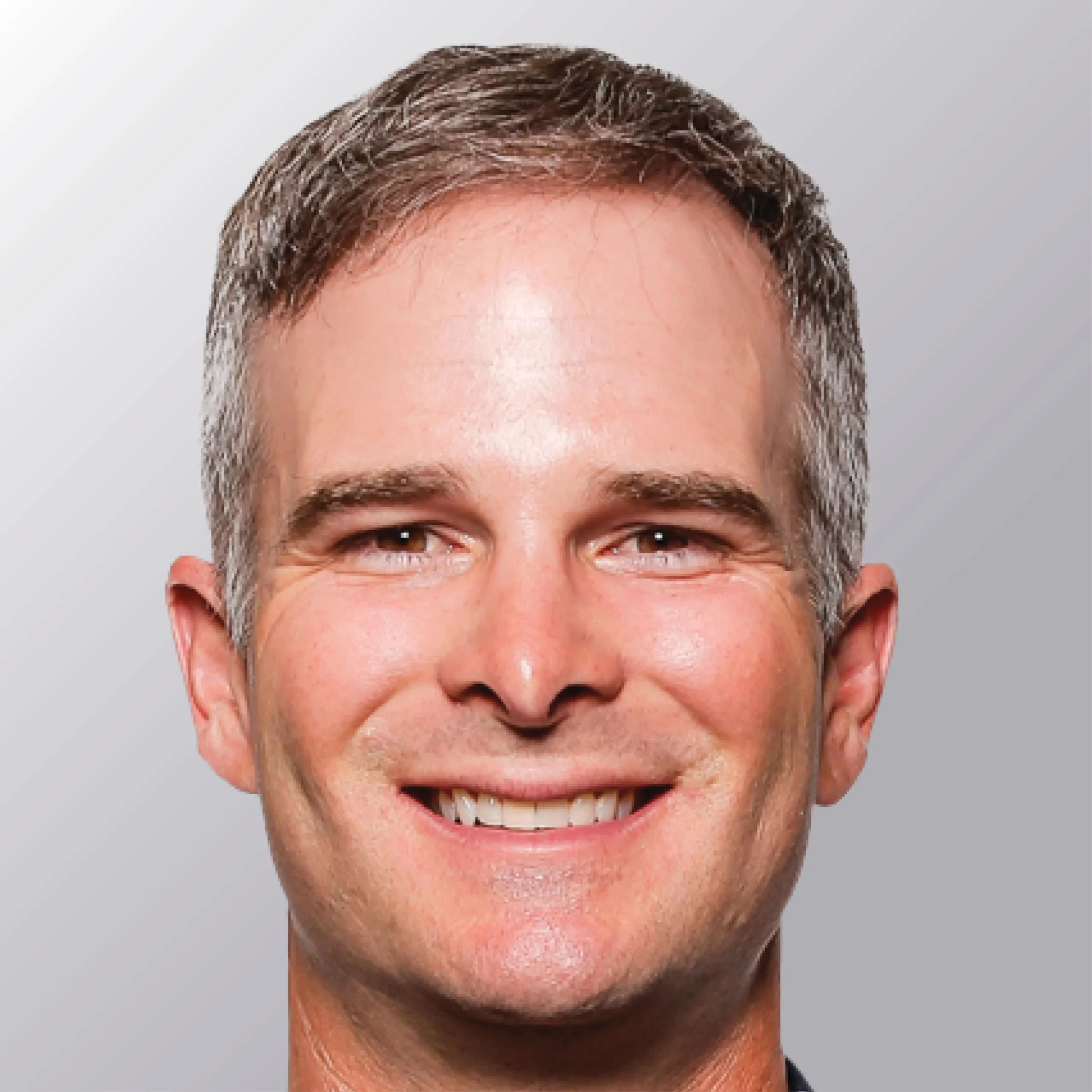 Kevin Streelman's After Hair Transplant