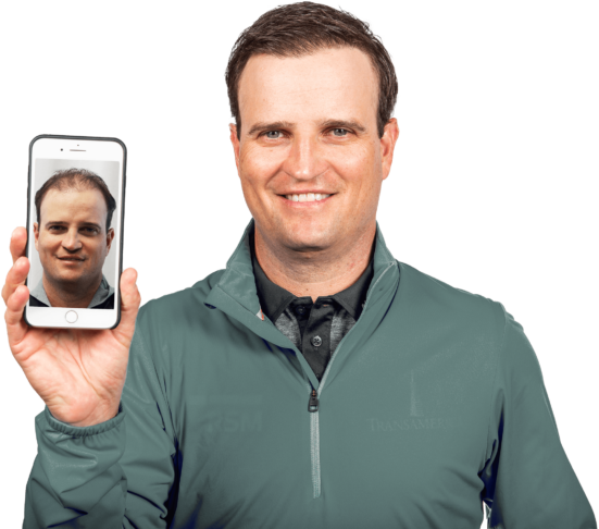 Zach Johnson RESTORE Hair Before and After